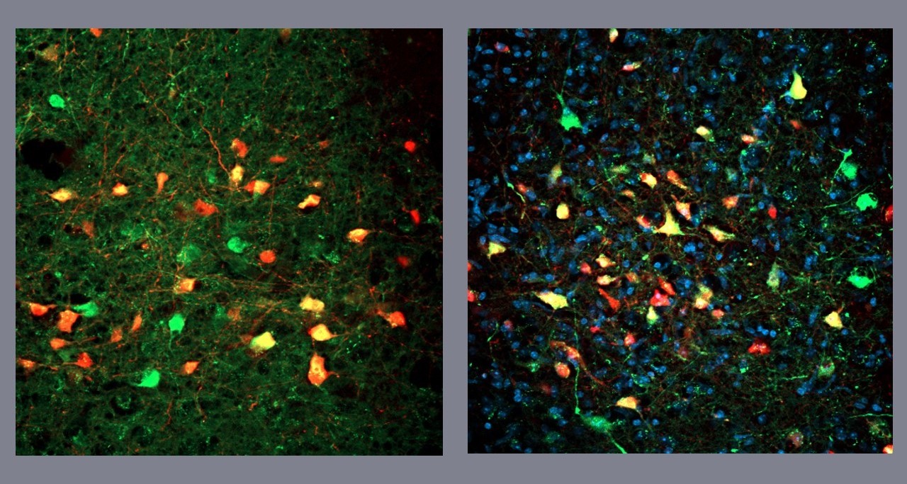 pesquisadores-descobrem-neuronios-que-deflagram-a-busca-frenetica-por-alimentos-mesmo-sem-fome